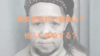 轟ちゃんは可愛くない 顔でかいにダウン症疑惑 整形箇所がスゴイ Kaznaoのエントピ 轟ちゃんは可愛くない 顔でかいにダウン症疑惑 整形箇所がスゴイ Kaznaoのエントピ
