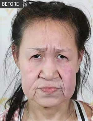 治療を受ける前のシャオ・フェンの顔